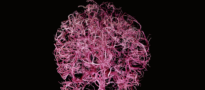 complex brain blood vessels